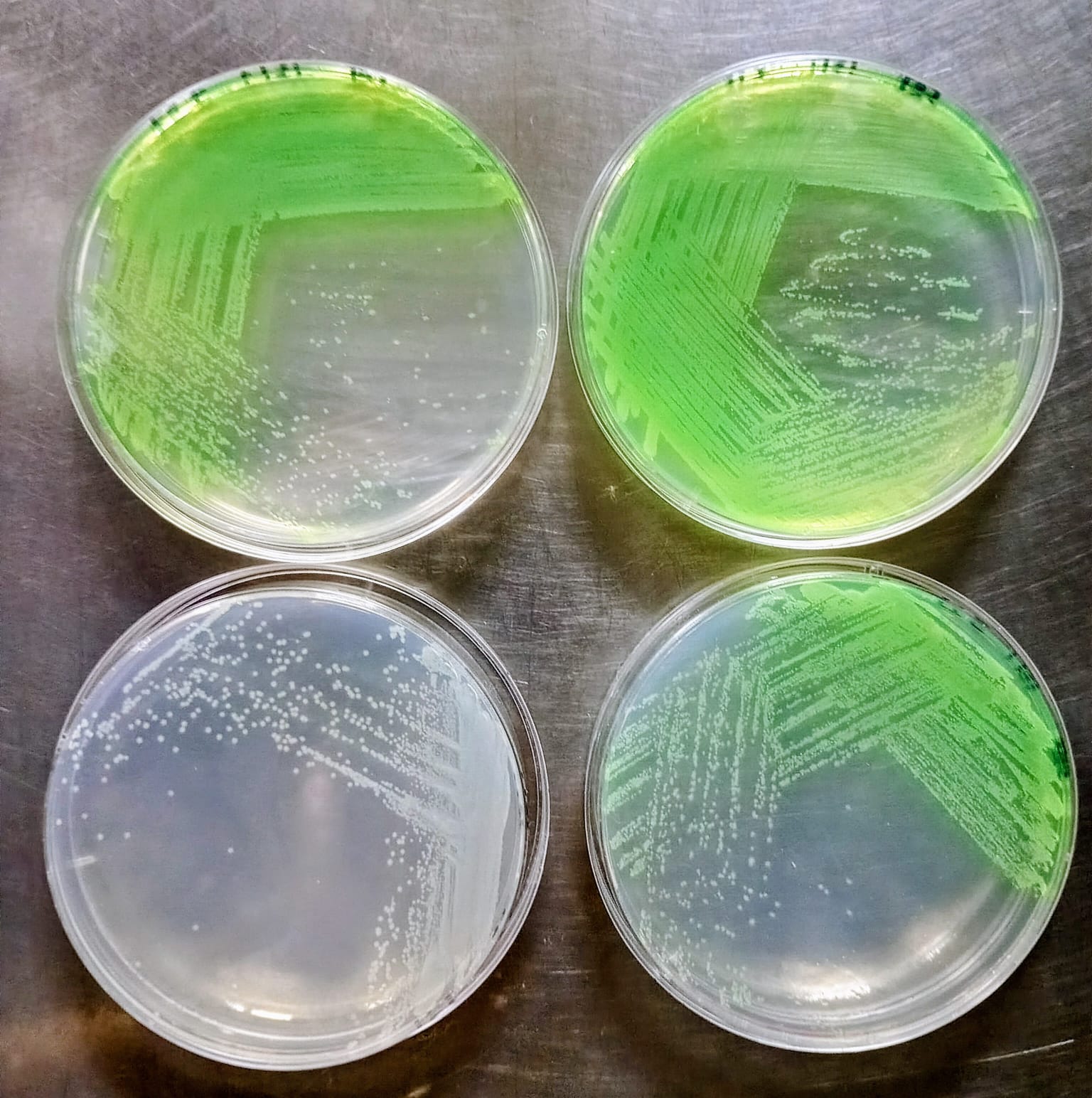 Desarrollo bacteriano en placas de agar Cetromide