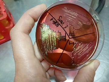 Desarrollo en agar EMB