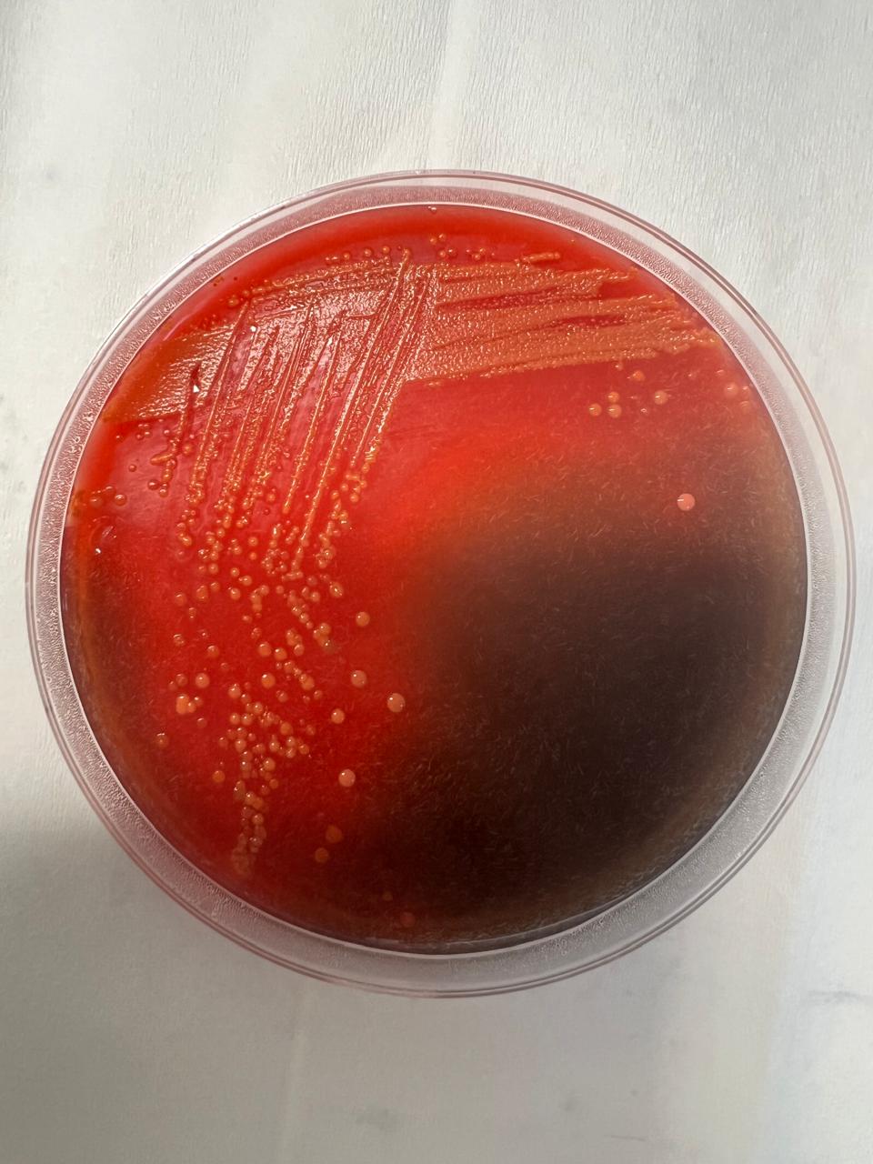 Desarrollo tipico de E. coli en agar Hektoen